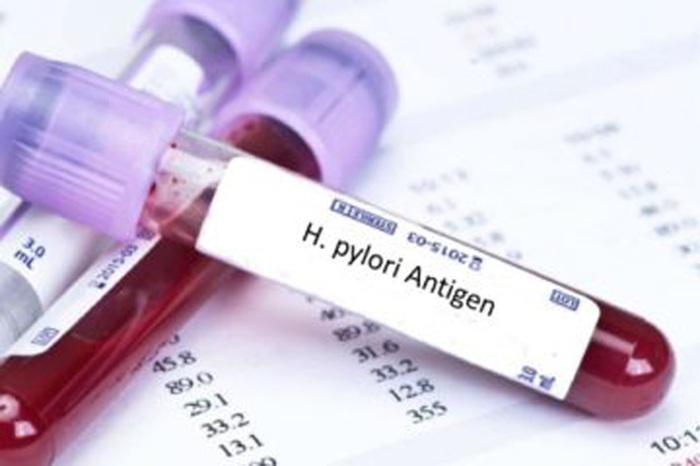 Xét nghiệm máu để nhận biết vi khuẩn HP