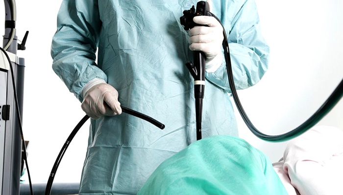 Không cố định thời gian nội soi đại tràng 