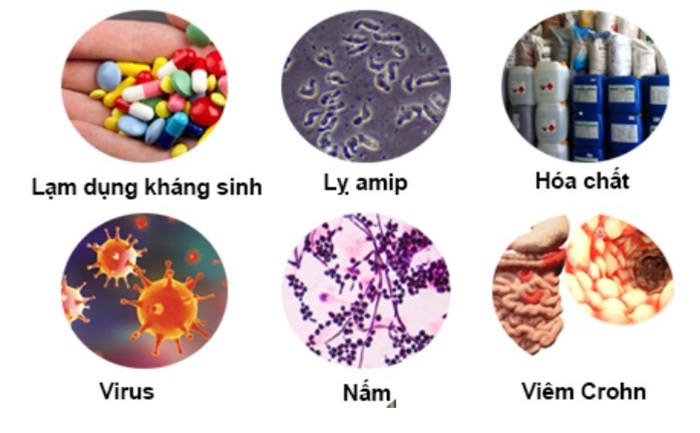 Có nhiều nguyên nhân dẫn tới viêm đại tràng