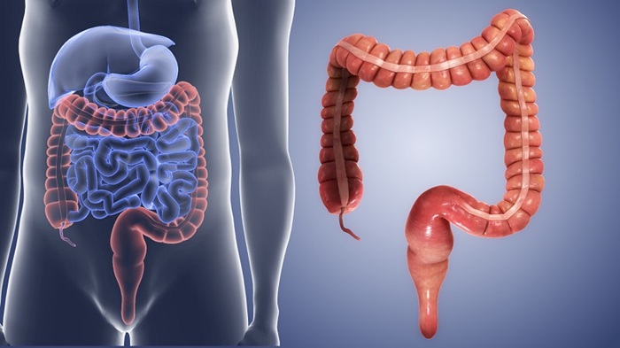 Không nên chủ quan khi bị viêm đại tràng, cần thăm khám sớm để có phác đồ phù hợp