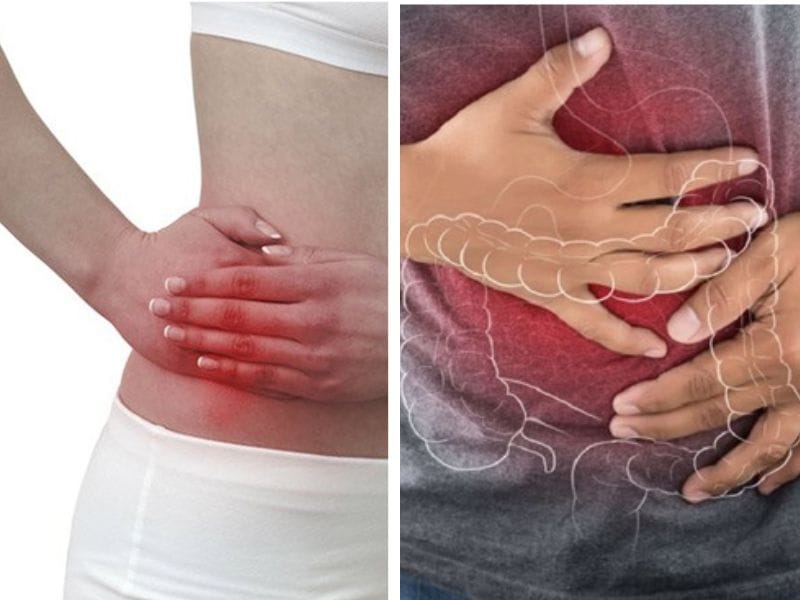 Phân biệt viêm ruột thừa và viêm đại tràng