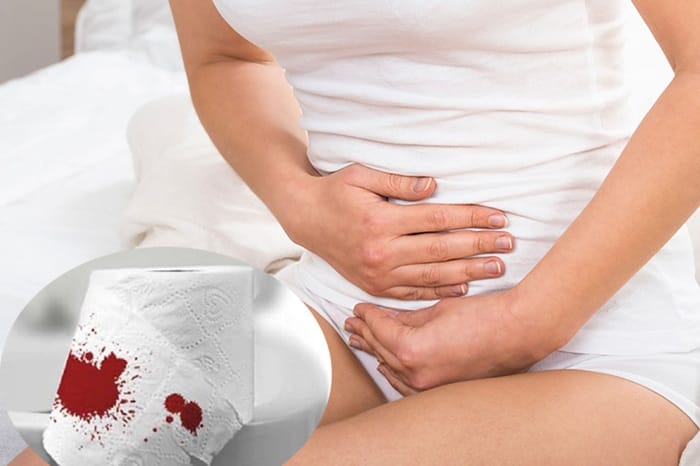 Cần đi khám ngay khi đau bụng đi ngoài nhiều lần kèm ra máu