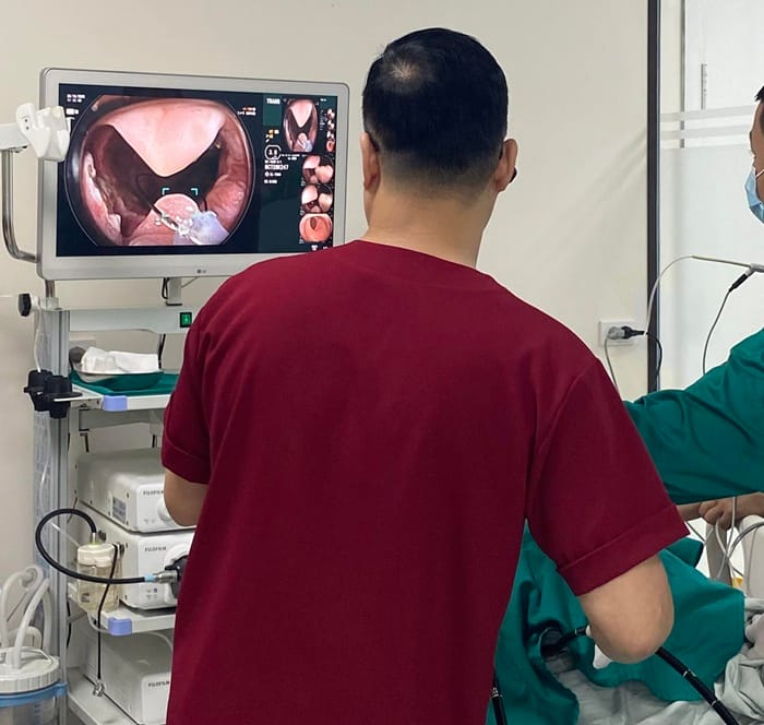 Nội soi điều trị trào ngược dạ dày nặng