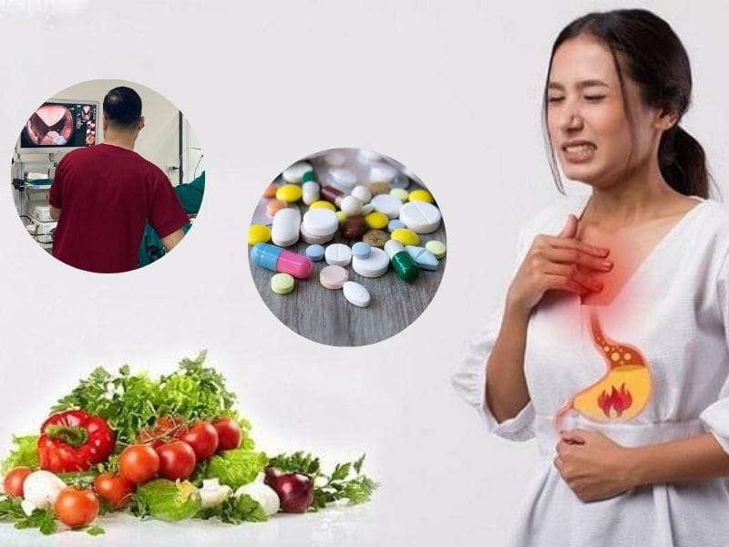 điều trị trào ngược dạ dày