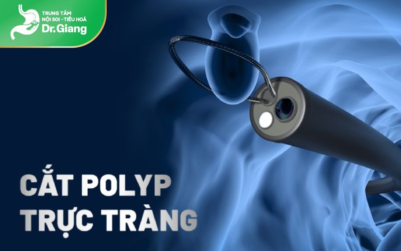 Cắt polyp bằng kẹp sinh thiết