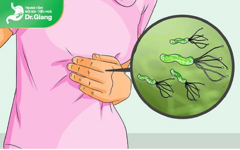 Người bị nhiễm khuẩn Helicobacter pylori nên nội soi dạ dày sớm hơn