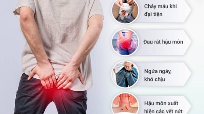 Nứt kẽ hậu môn thường gây đau rát, đặc biệt là khi đi đại tiện
