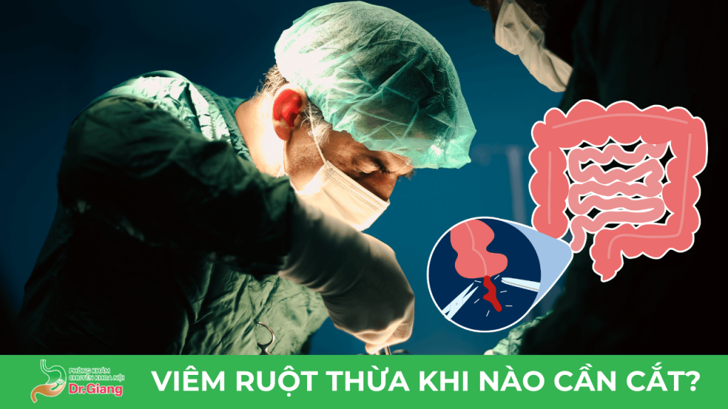 VIÊM RUỘT THỪA KHI NÀO CẦN CẮT?