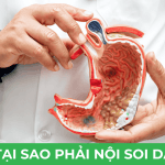 Tại sao phải nội soi dạ dày?