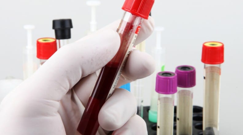 Xét nghiệm máu là một trong các phương pháp khám dạ dày không cần nội soi