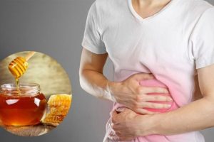 Cách chữa trào ngược dạ dày bằng mật ong
