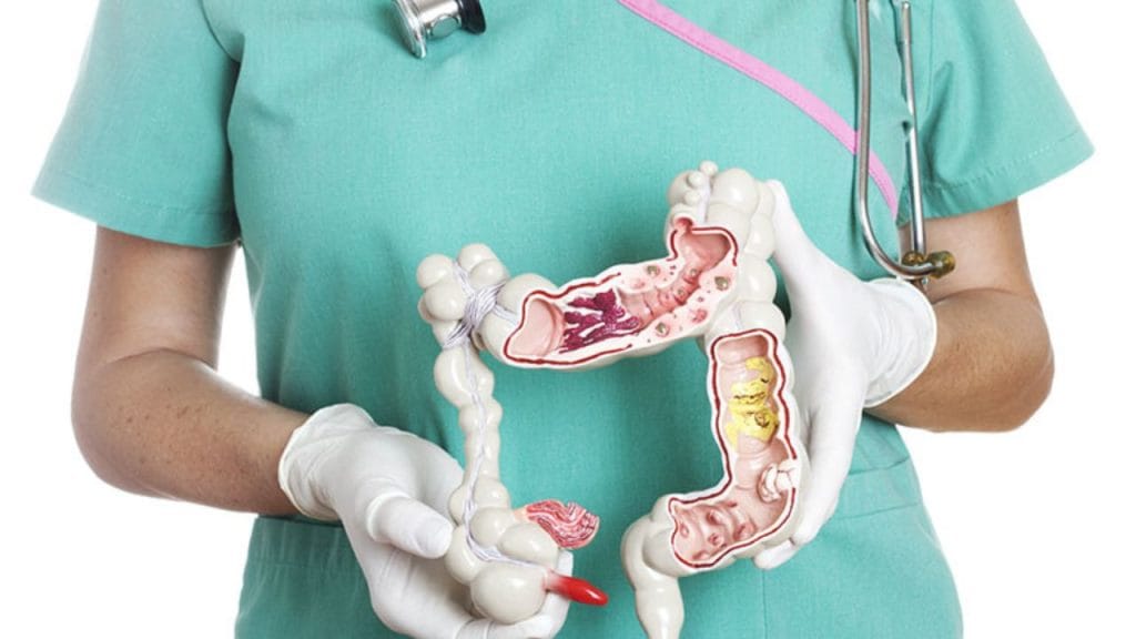 Khám đại tràng không cần nội soi cần lưu ý điều gì?