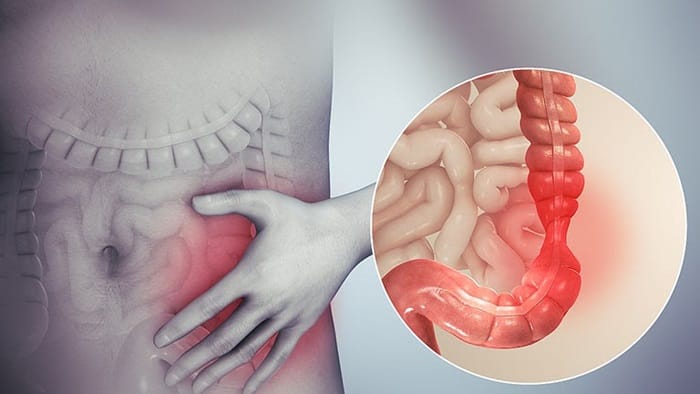 Xuất hiện dấu hiệu bất thường như đau bụng kéo dài, táo bón