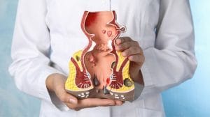 Mổ nứt kẽ hậu môn bao lâu thì lành? Các mốc thời gian cần biết