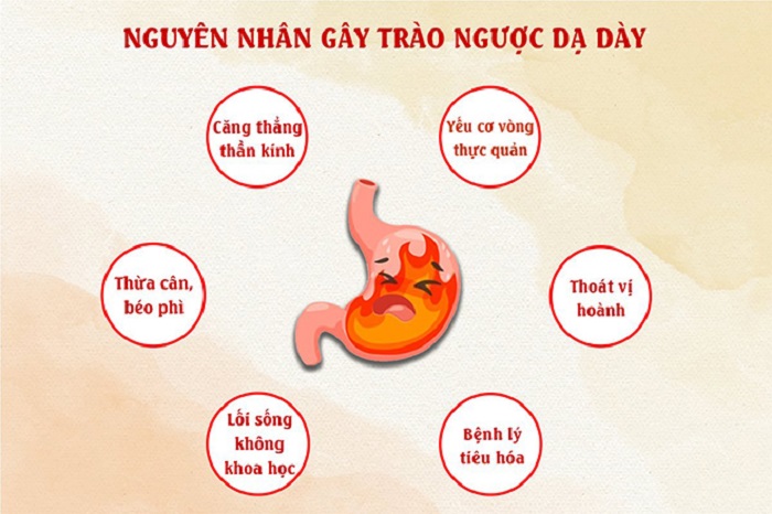 Trào ngược dạ dày có thể do cơ vòng thực quản suy yếu hoặc lối sống không khoa học