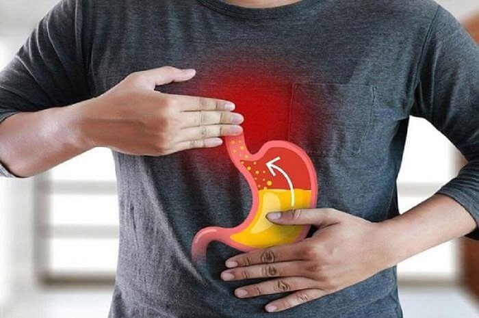 Đau tức ngực, nóng rát, ợ chua có thể cảnh báo chứng trào ngược dạ dày