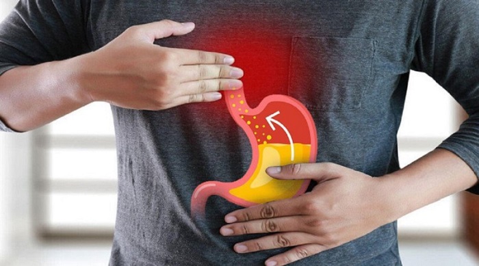 Trào ngược dạ dày khiến người bệnh khó chịu