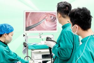 Chuẩn bị gì trước khi nội soi trực tràng? Một số thông tin quan trọng