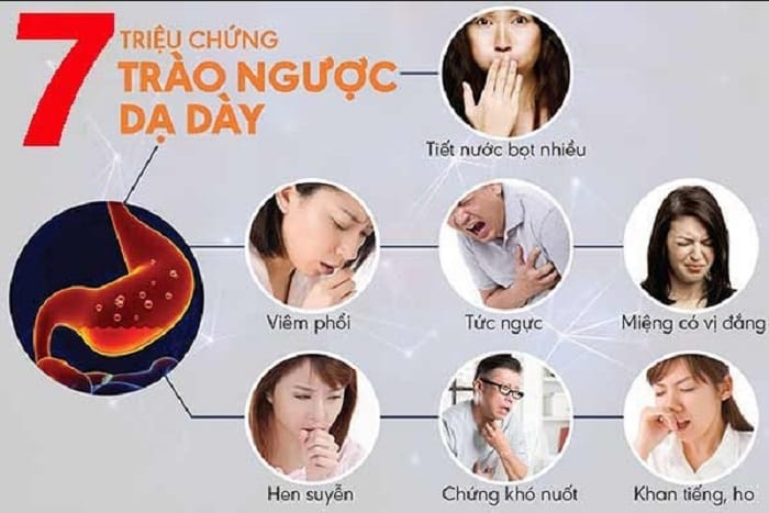 Ợ chua, ợ nóng, tức ngực là những triệu chứng trào ngược dạ dày