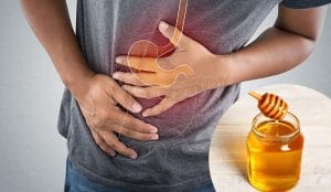 Trào ngược dạ dày uống mật ong được không? bác sĩ giải đáp