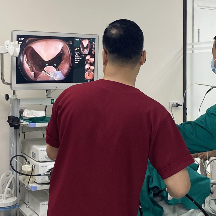 Nội soi dạ dày gây mê giá bao nhiêu? Bảng giá mới nhất