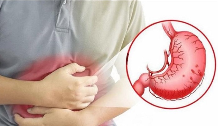 Nên lựa chọn địa chỉ khám tiêu khóa có đội ngũ bác sĩ giỏi chuyên môn